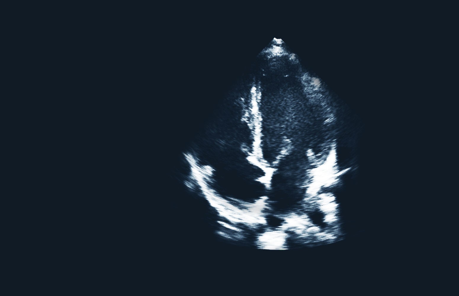 Echocardiography Essentials