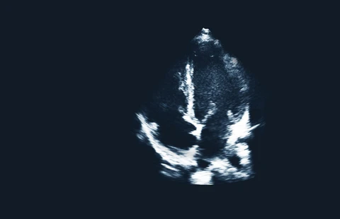 Echocardiography Essentials