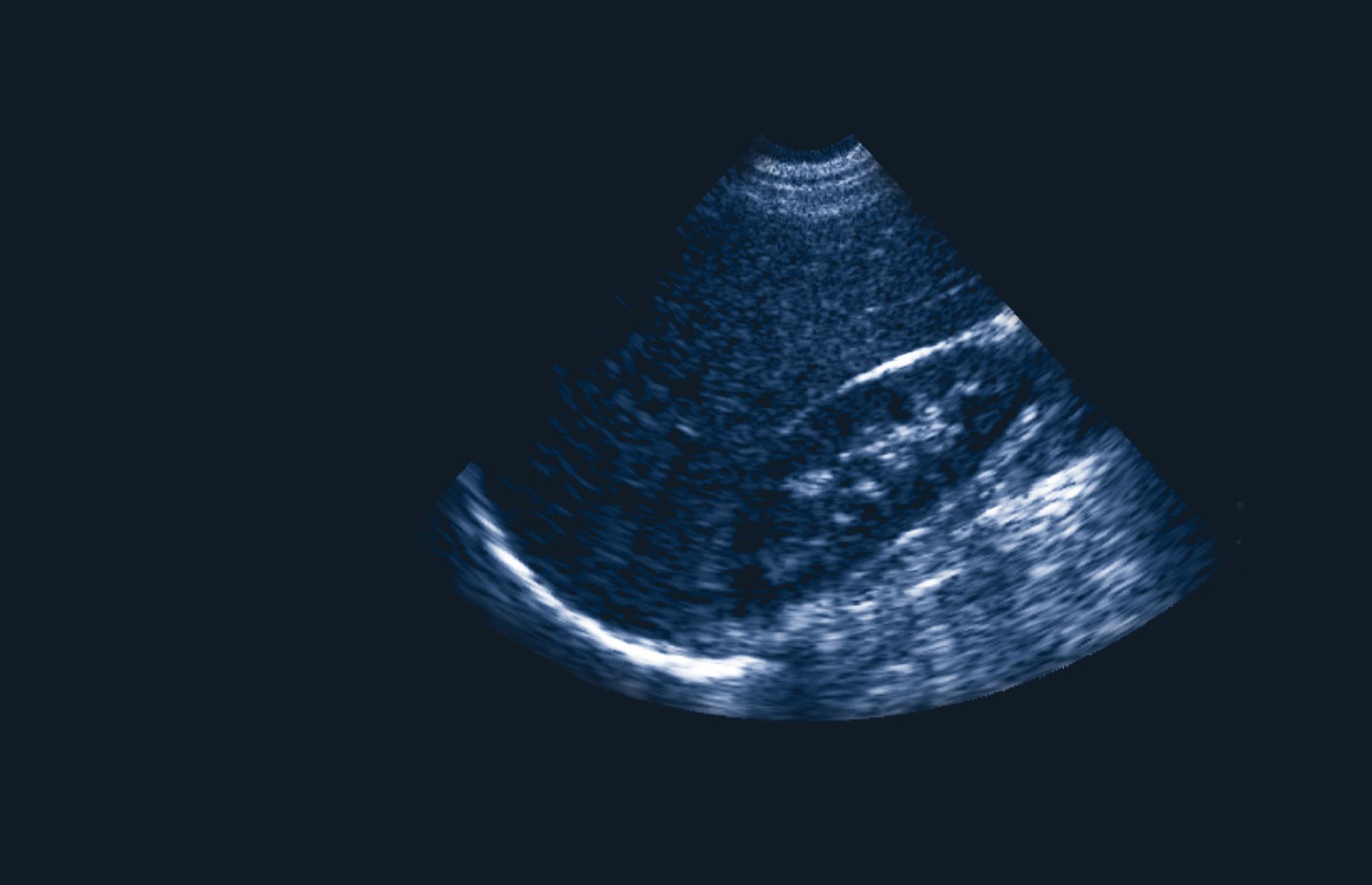 Point-of-Care Ultrasound Essentials