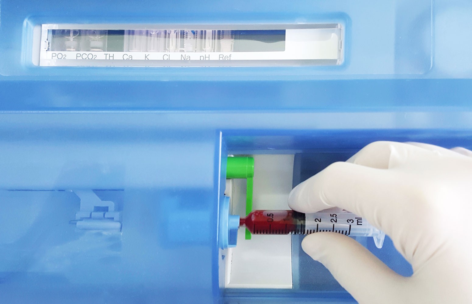 Blood Gas Analysis Essentials
