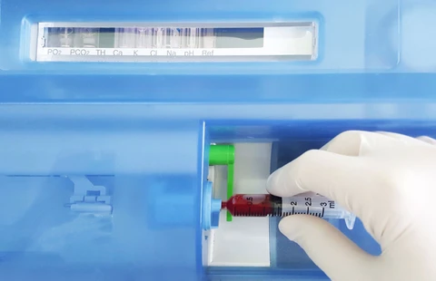 Blood Gas Analysis Essentials