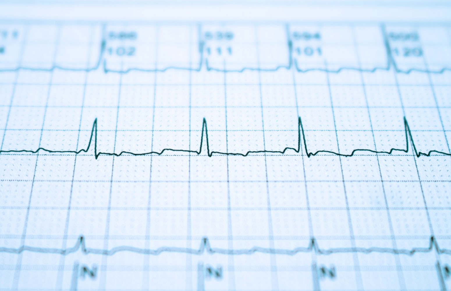 ECG Mastery: Yellow Belt