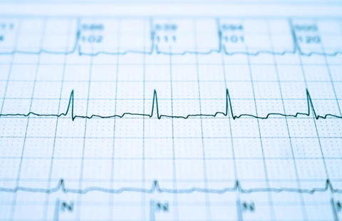 ECG Mastery: Yellow Belt