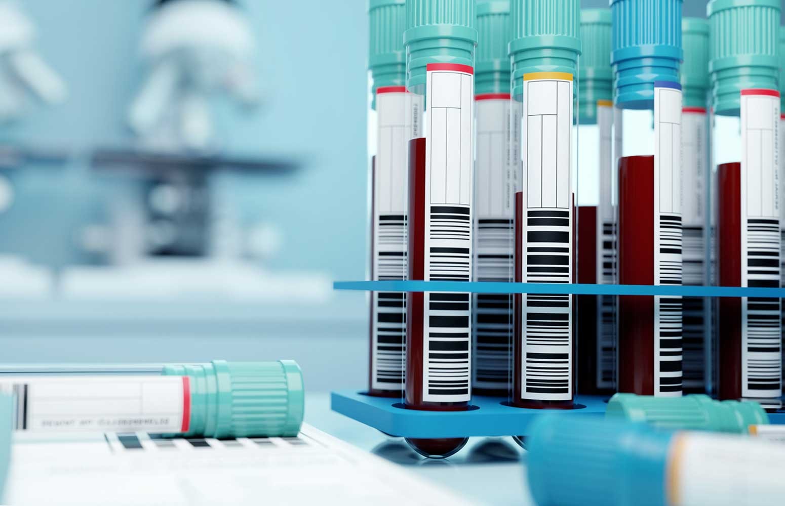 Hyperlipidemia Essentials