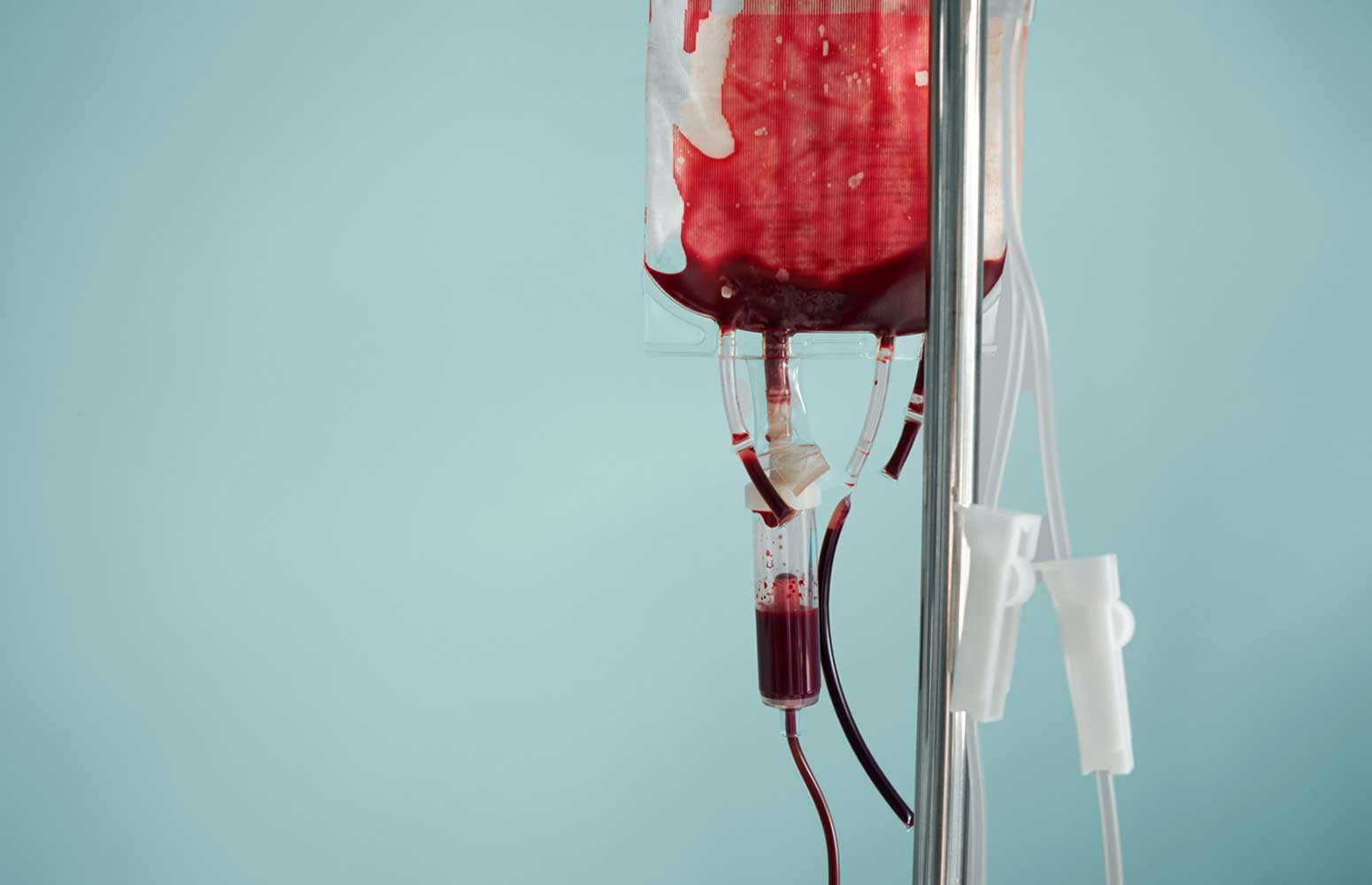 Transfusion Medicine Essentials