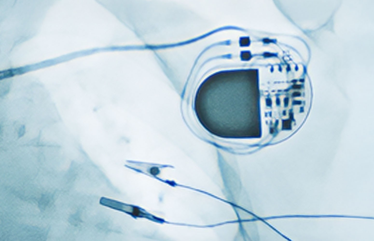 Pacemaker Essentials