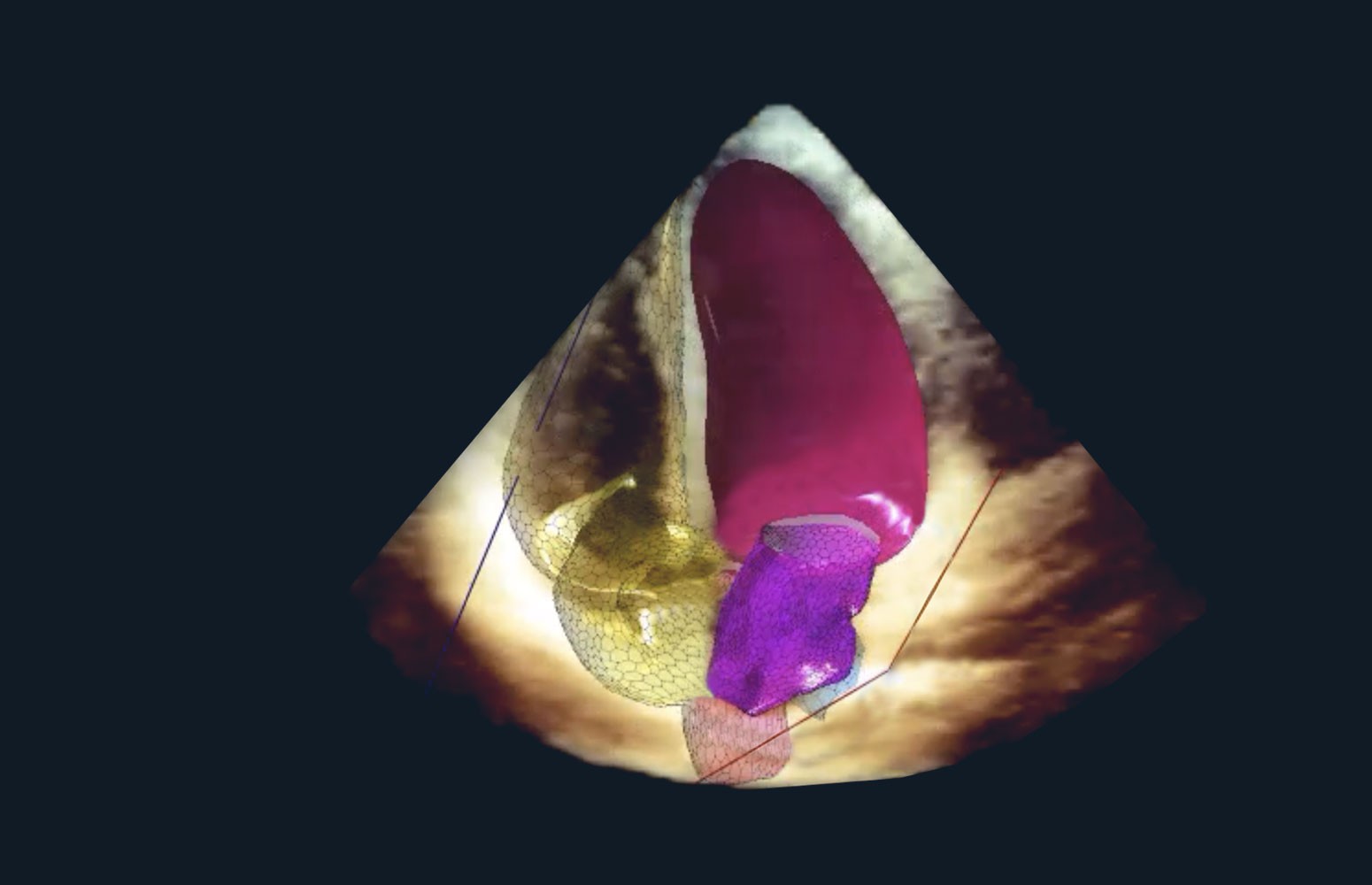 Echo Masterclass: The Power of 3D Imaging