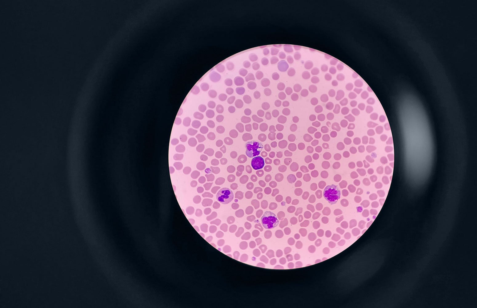 Hematology and Coagulation Essentials
