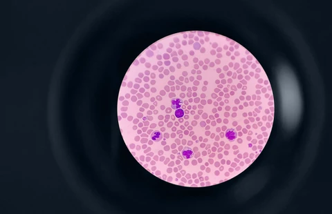 Hematology and Coagulation Essentials