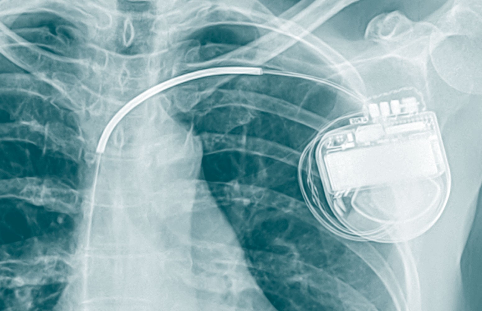 ICD Essentials