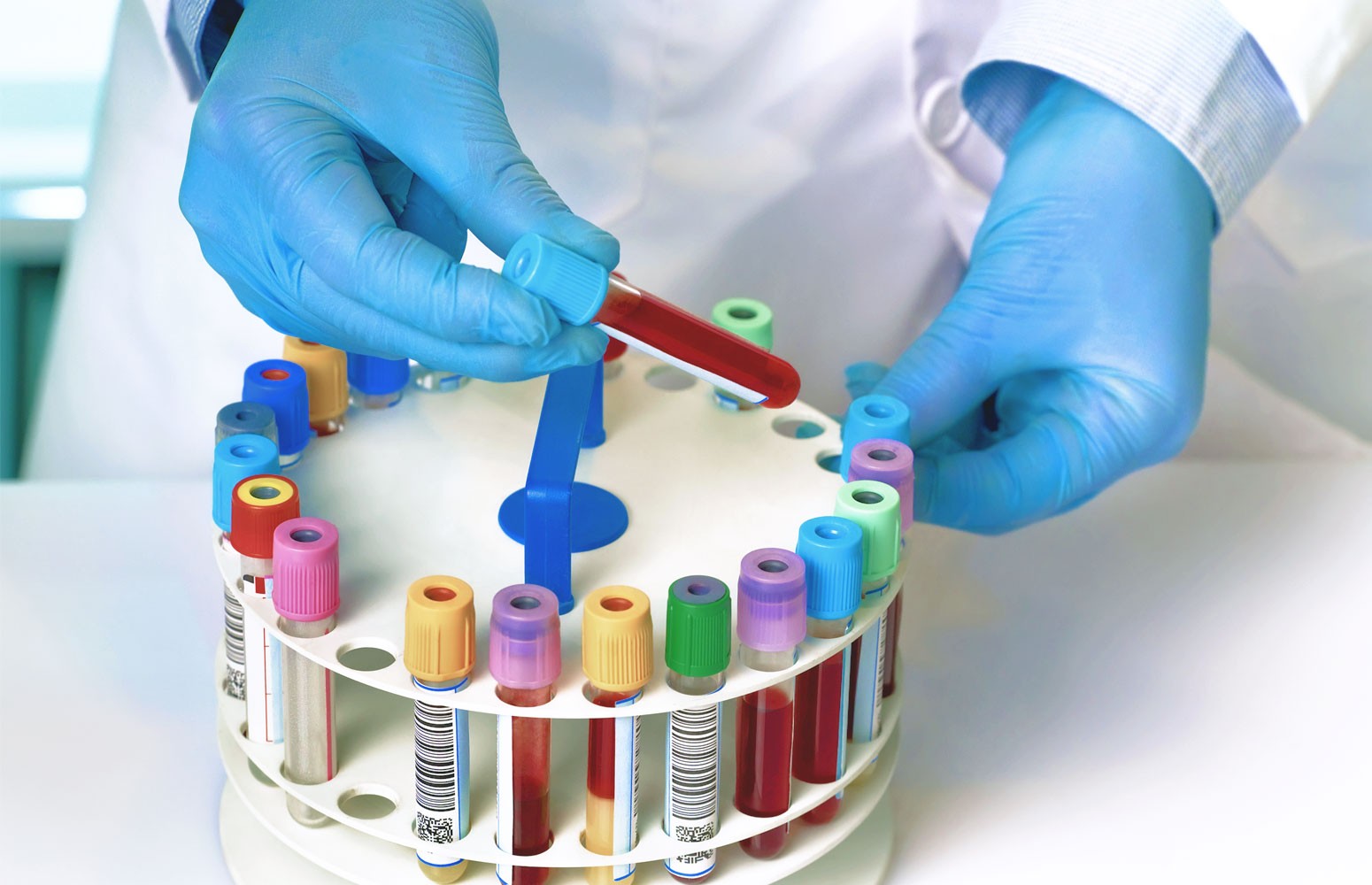 Kidney Function Test Essentials