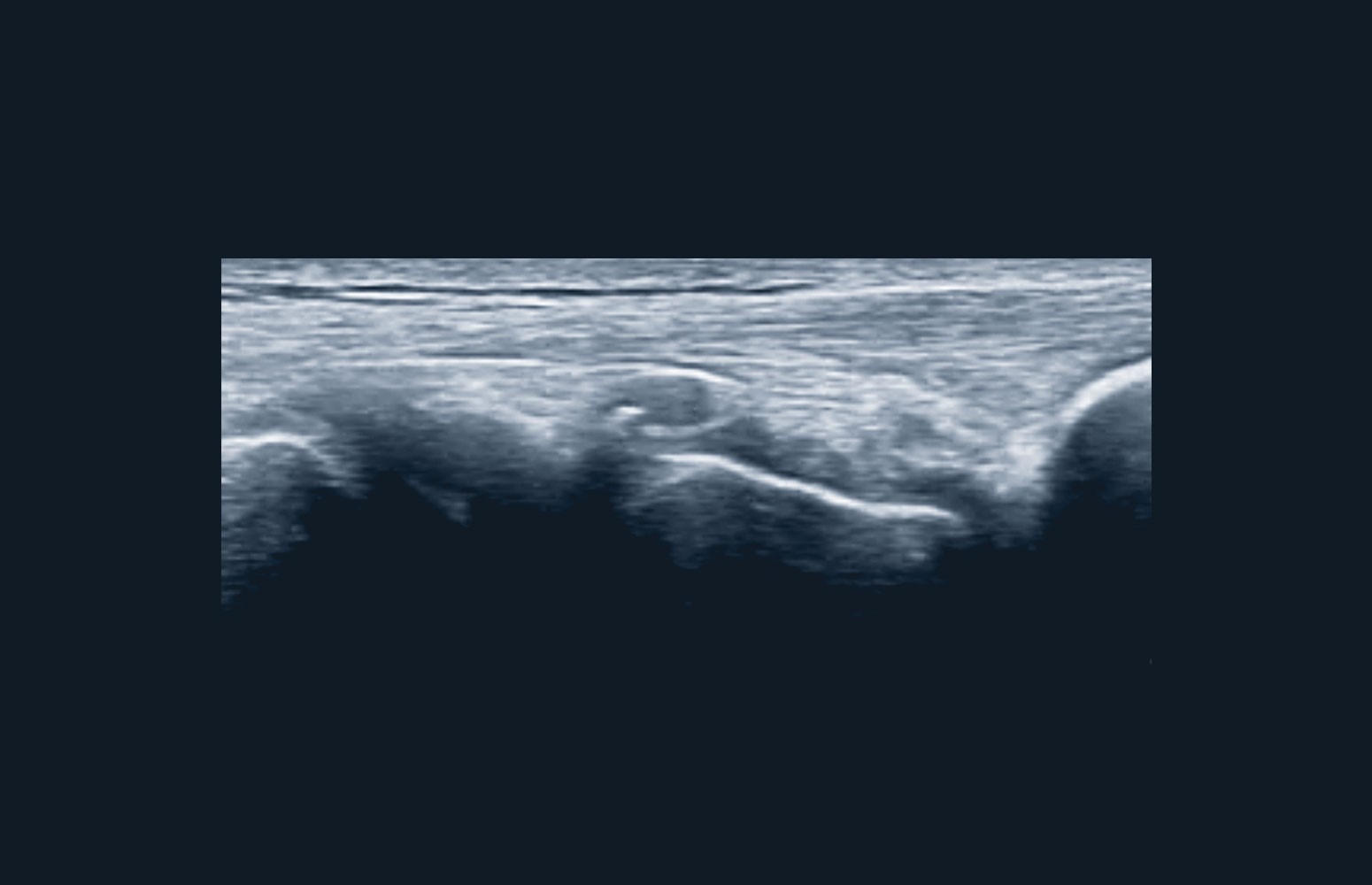Musculoskeletal Ultrasound Masterclass
