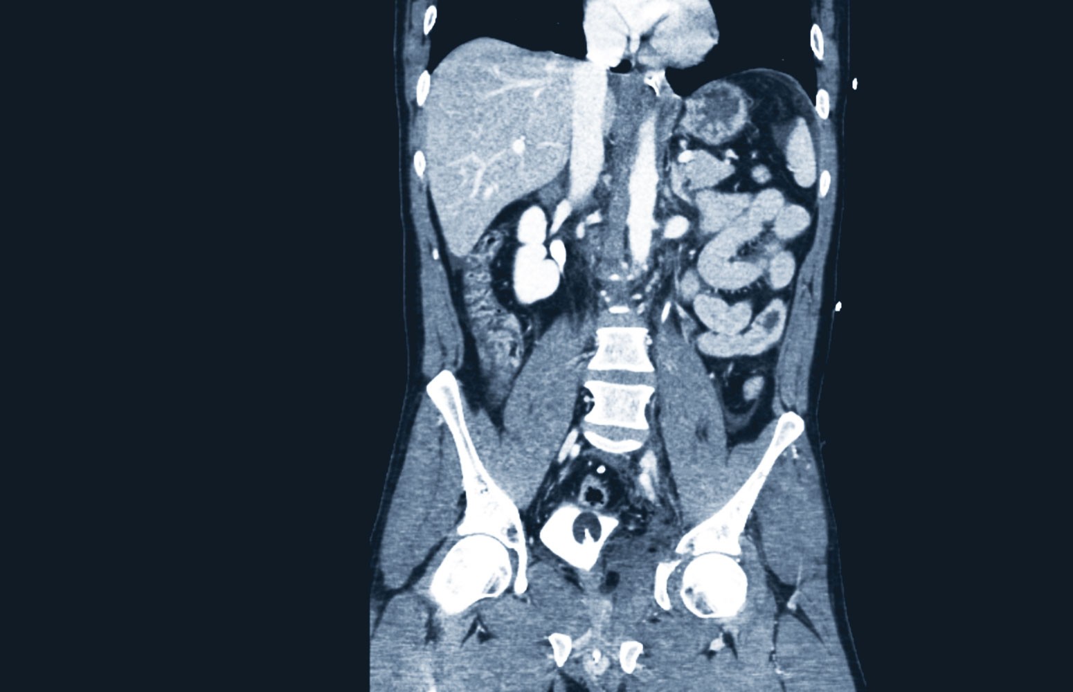 Abdominal CT Masterclass: Trauma