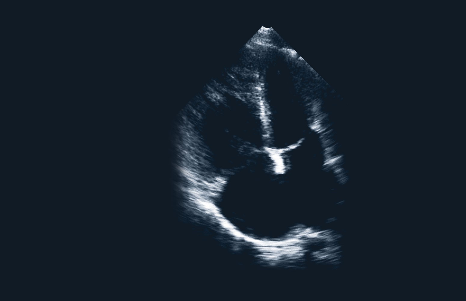 Echo Masterclass: Adult Congenital Heart Disease
