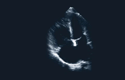 Echo Masterclass: Adult Congenital Heart Disease