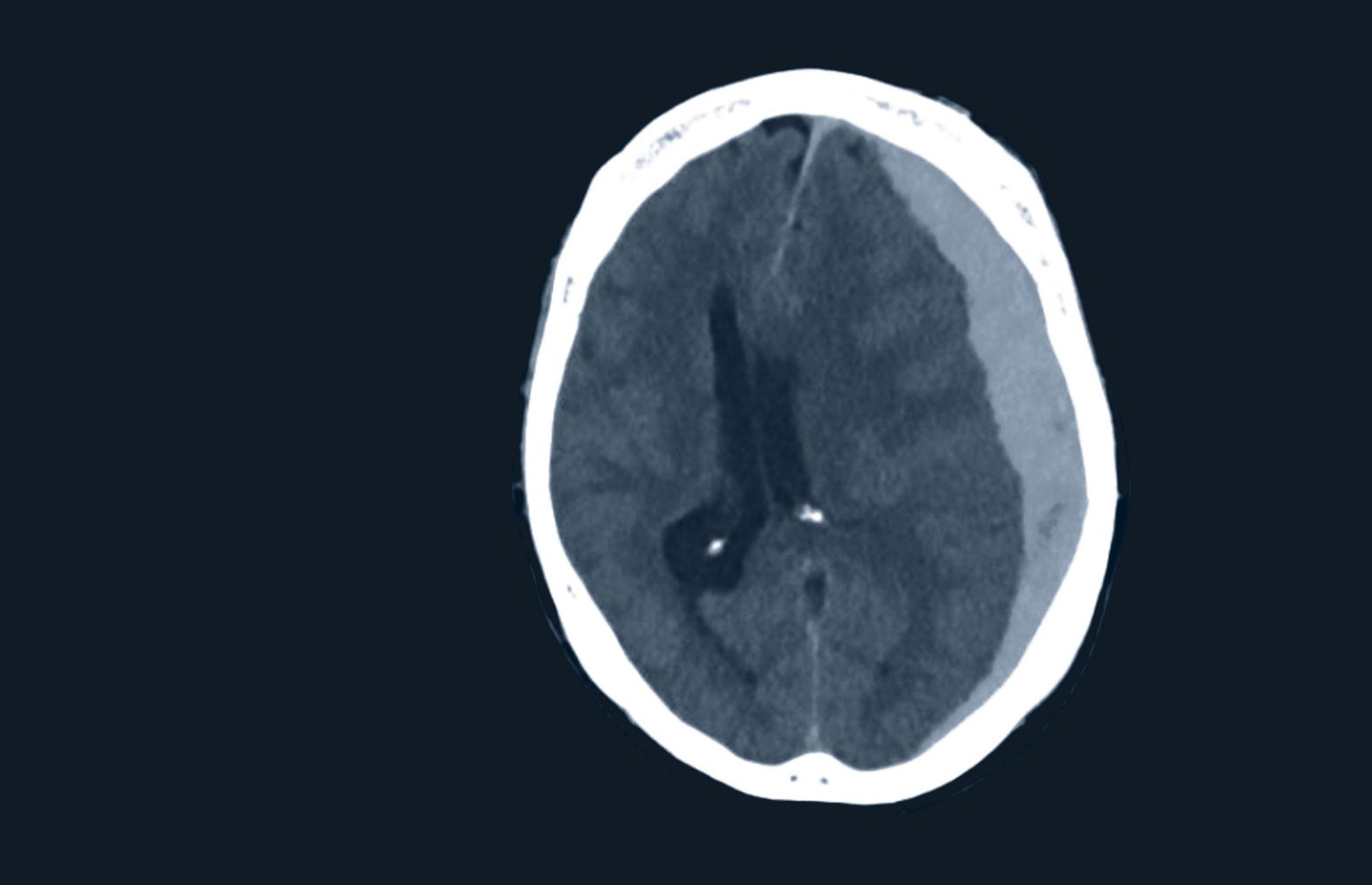 Brain CT Essentials