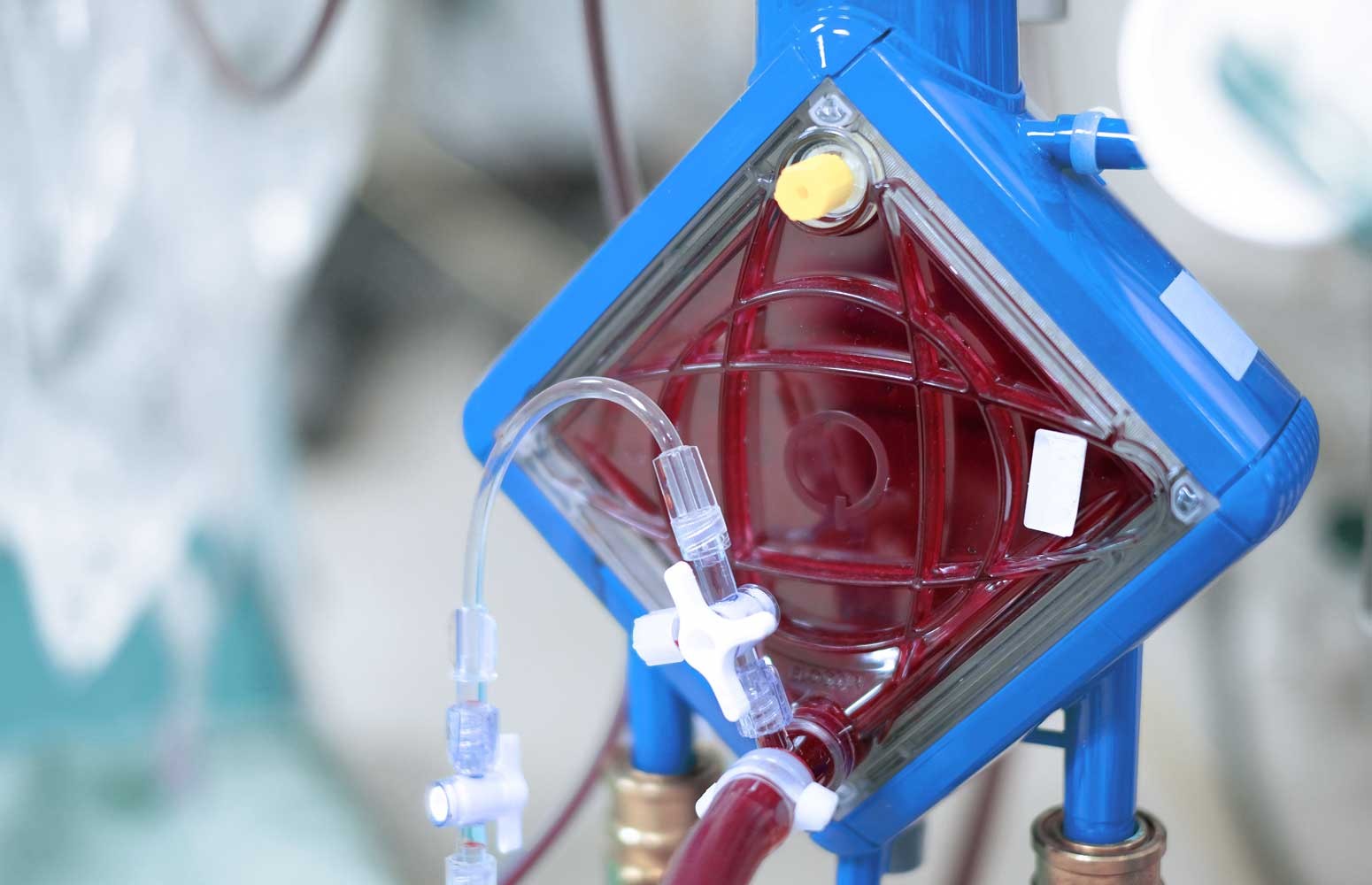 Temporary Mechanical Circulatory Support