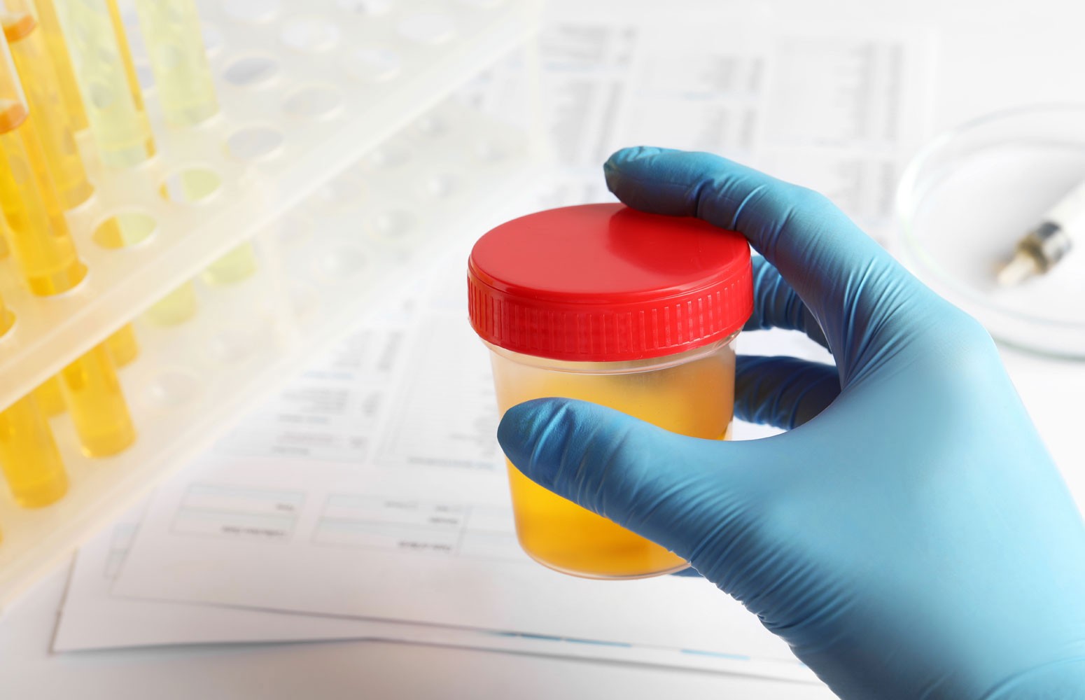 Body Fluid Lab Essentials