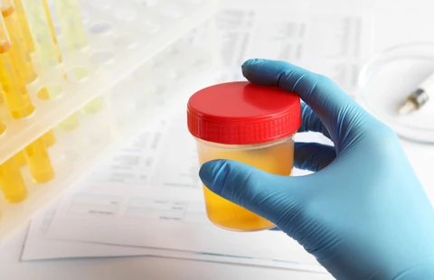 Body Fluid Lab Essentials