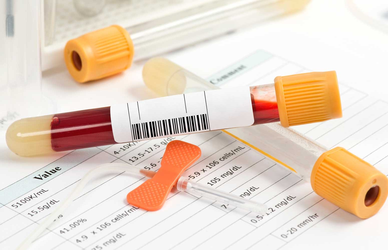 Viral Hepatitis Lab Essentials