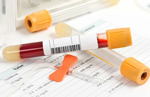 Fundamentos del laboratorio en la hepatitis viral