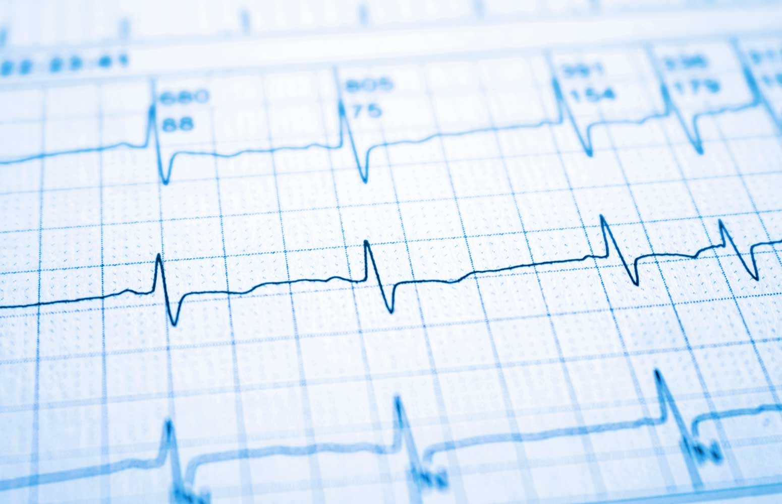 ECG Mastery: Blue Belt