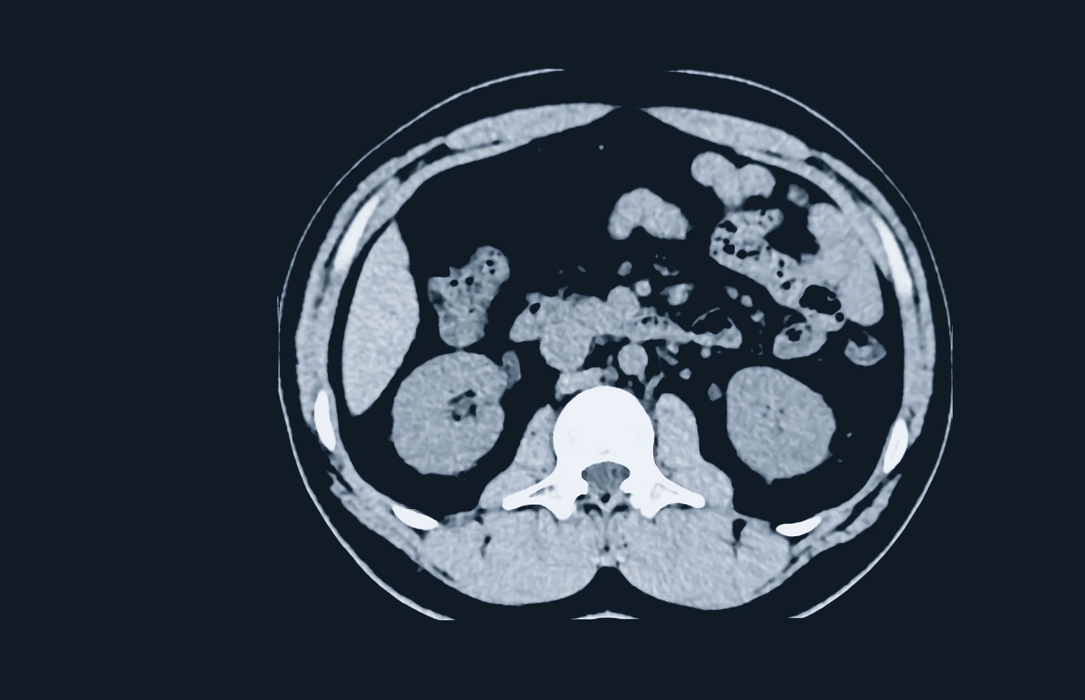 Abdominal CT Essentials