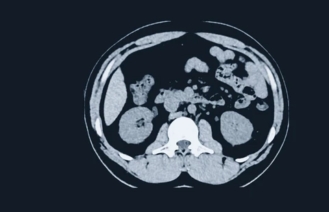 Grundlagen der Abdominal-CT