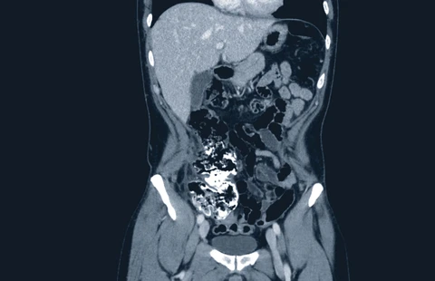 Abdominal CT Masterclass: Common Pathologies