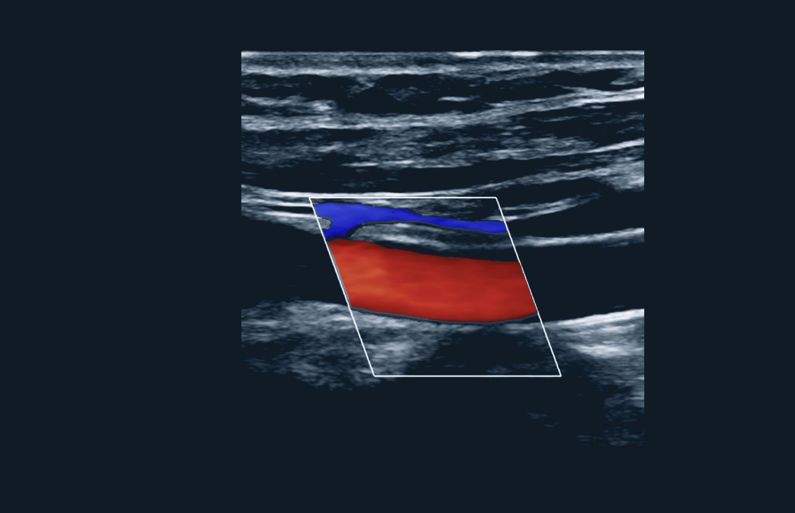 Ultrasound Masterclass: The Carotid Artery
