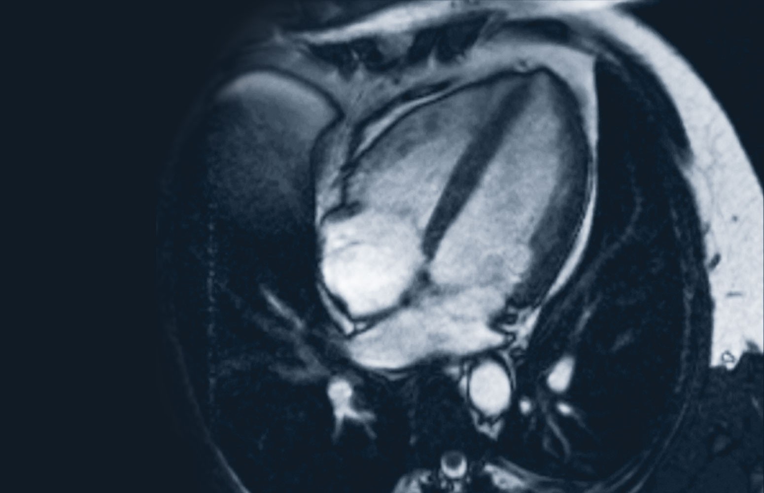 Cardiac MRI Essentials