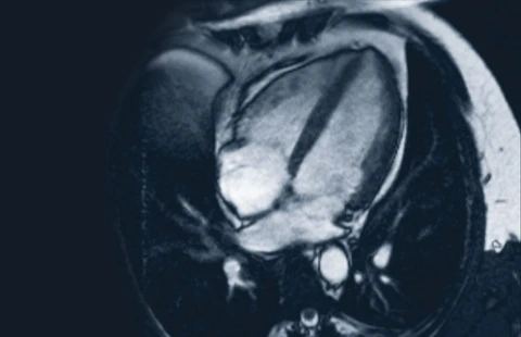 Cardiac MRI Essentials