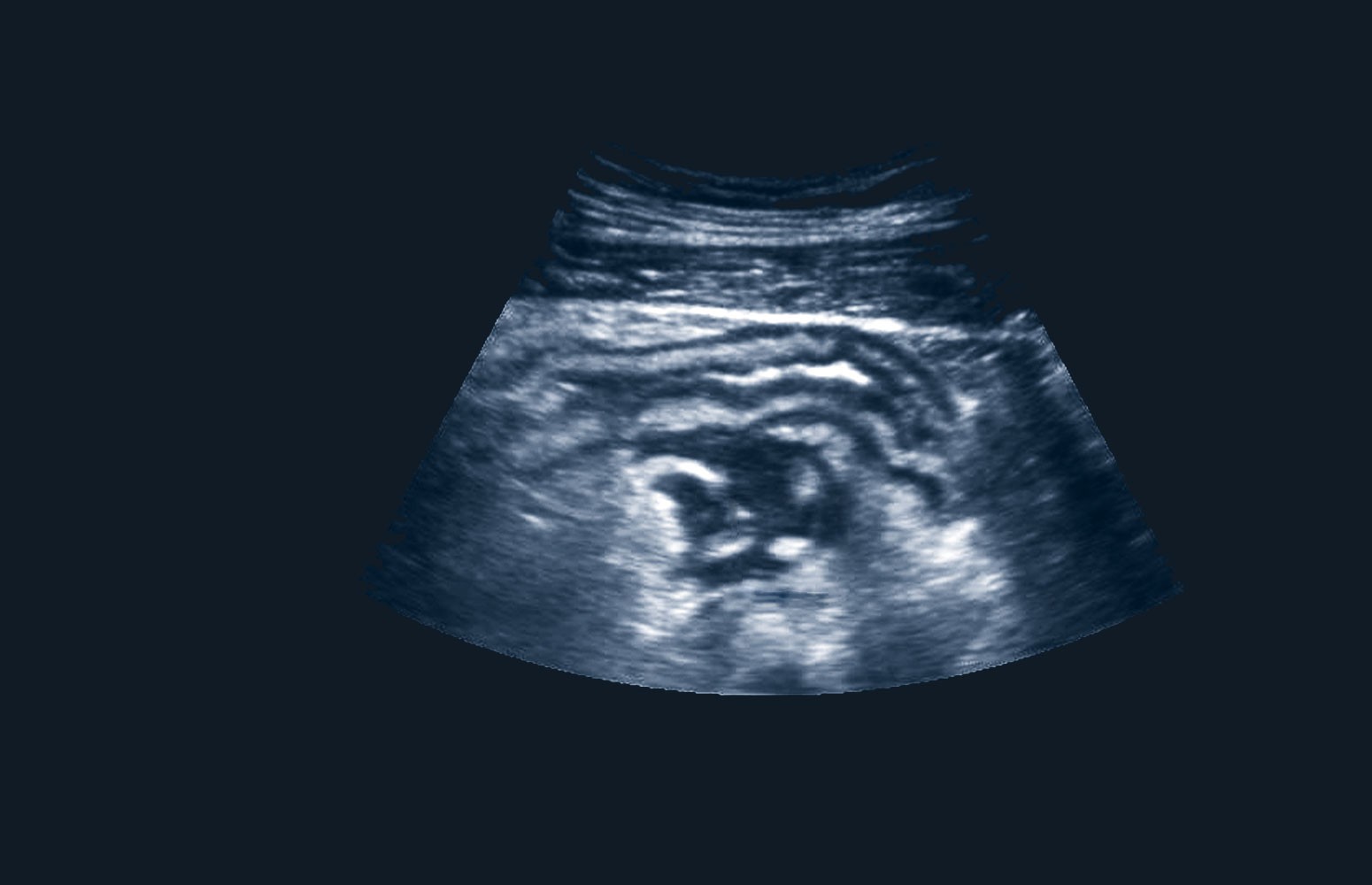 Point-of-Care Ultrasound Masterclass