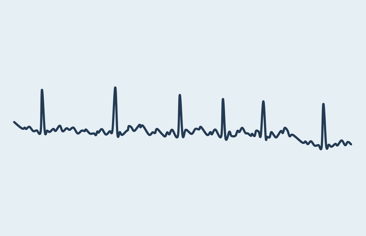 Atrial Fibrillation Management Essentials