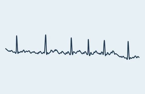 Atrial Fibrillation Management Essentials