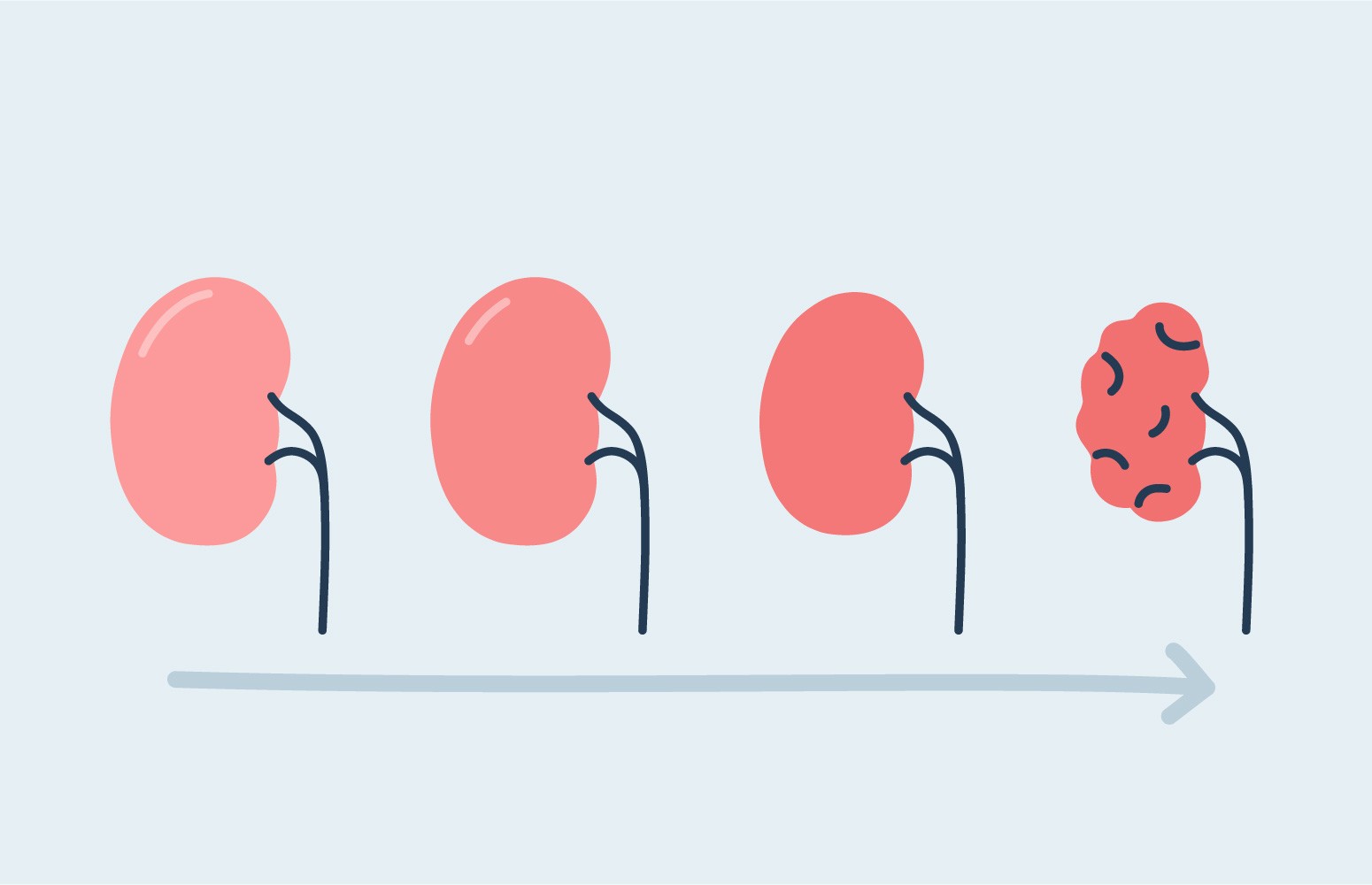 Chronic Kidney Disease Essentials