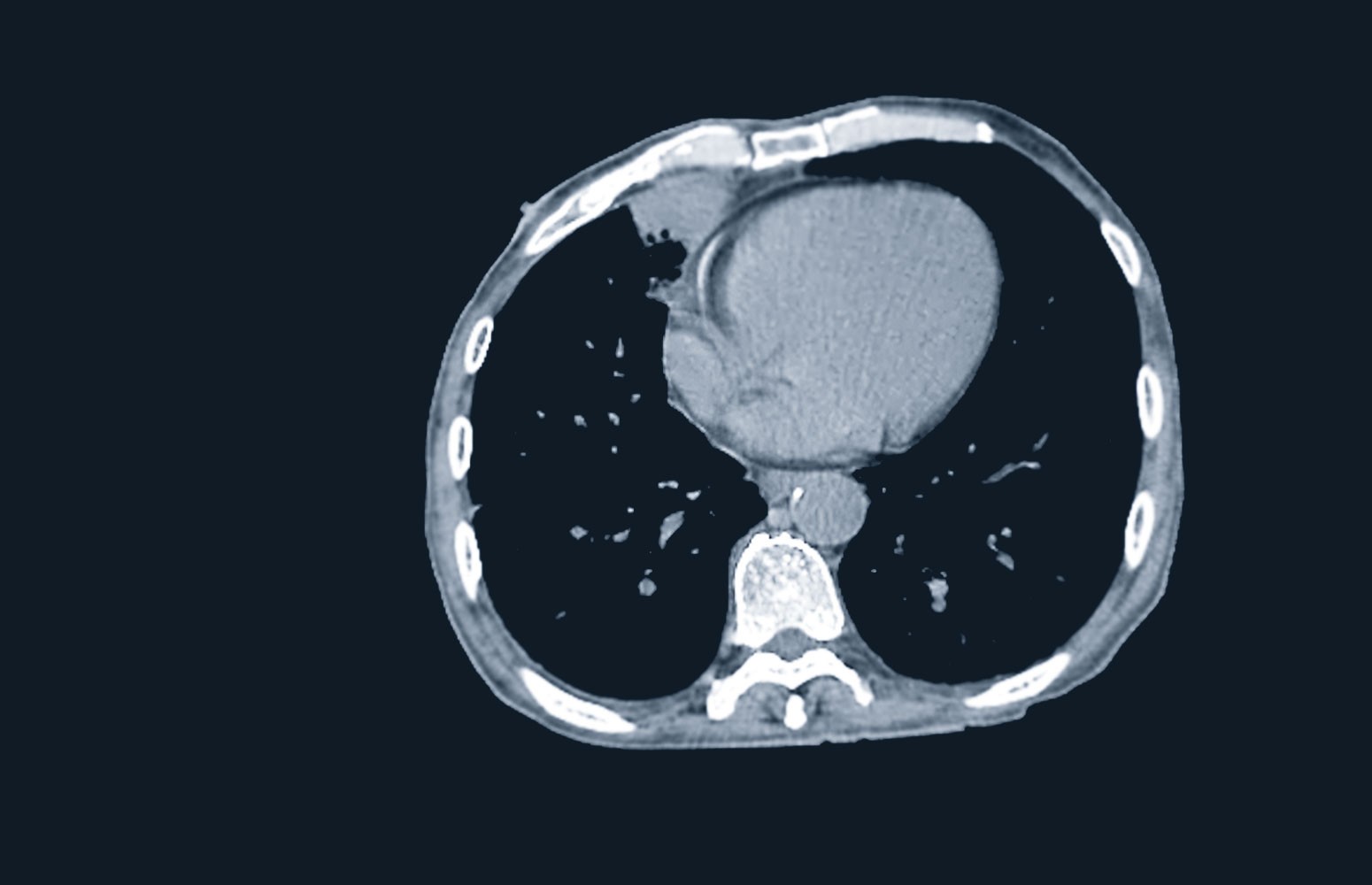 Chest CT Essentials Workshop