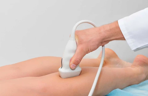 Ultrasound Workshop: Veins of the Legs