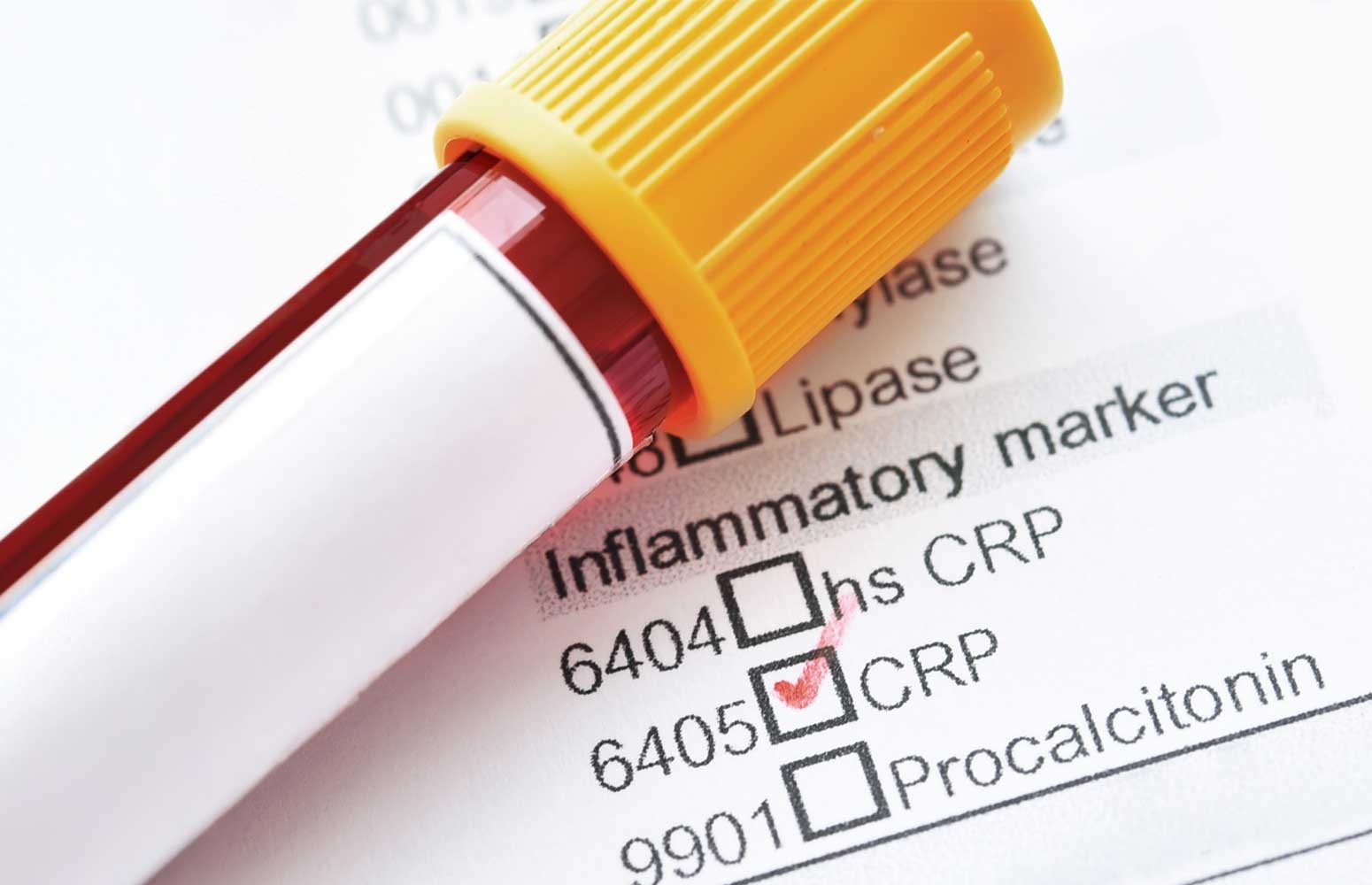 Inflammatory Markers Essentials Workshop