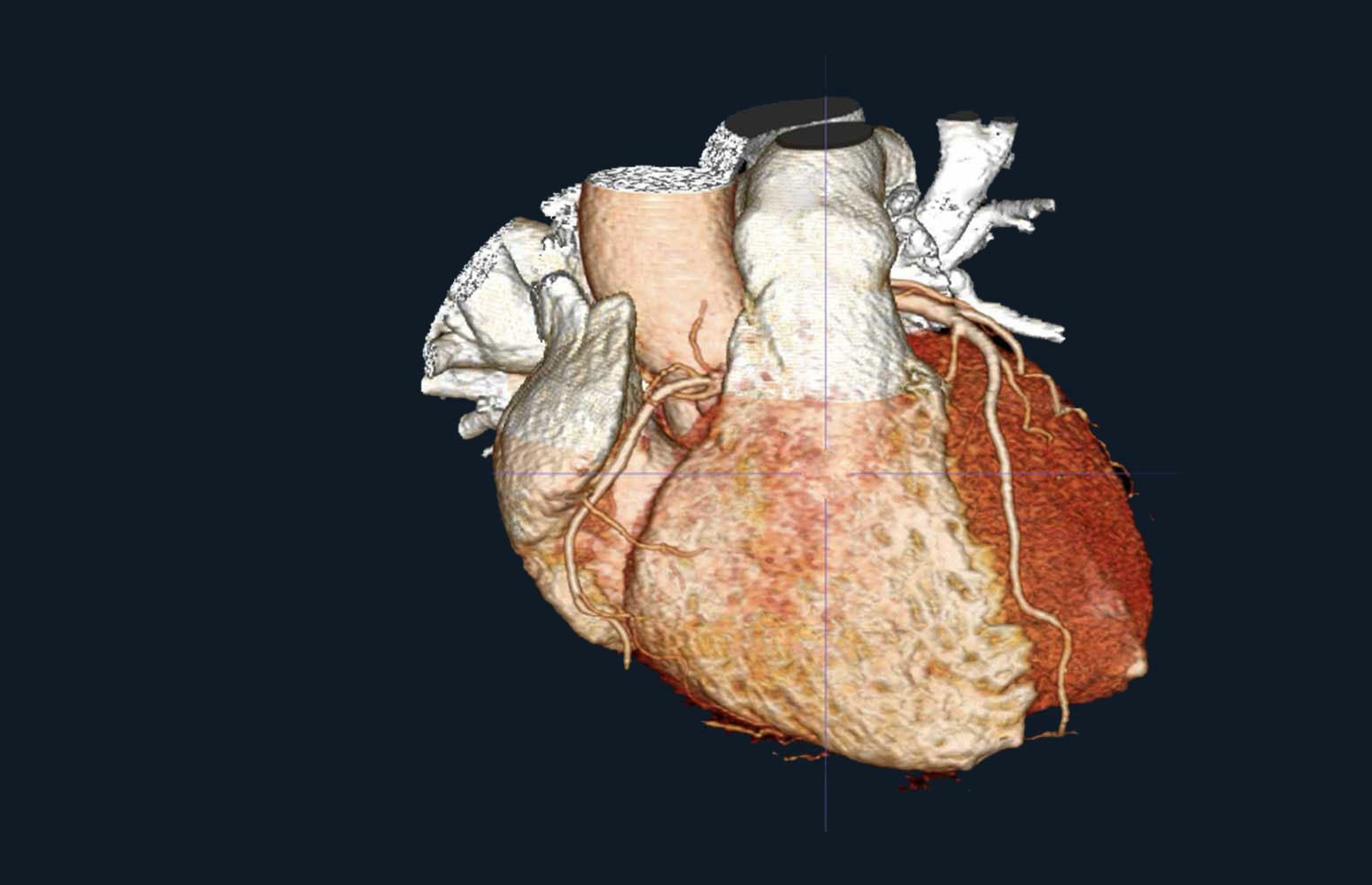 Cardiac CT Mastery Workshop