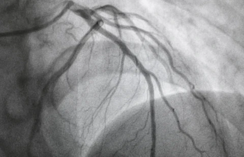 Coronary Angiography Essentials Workshop