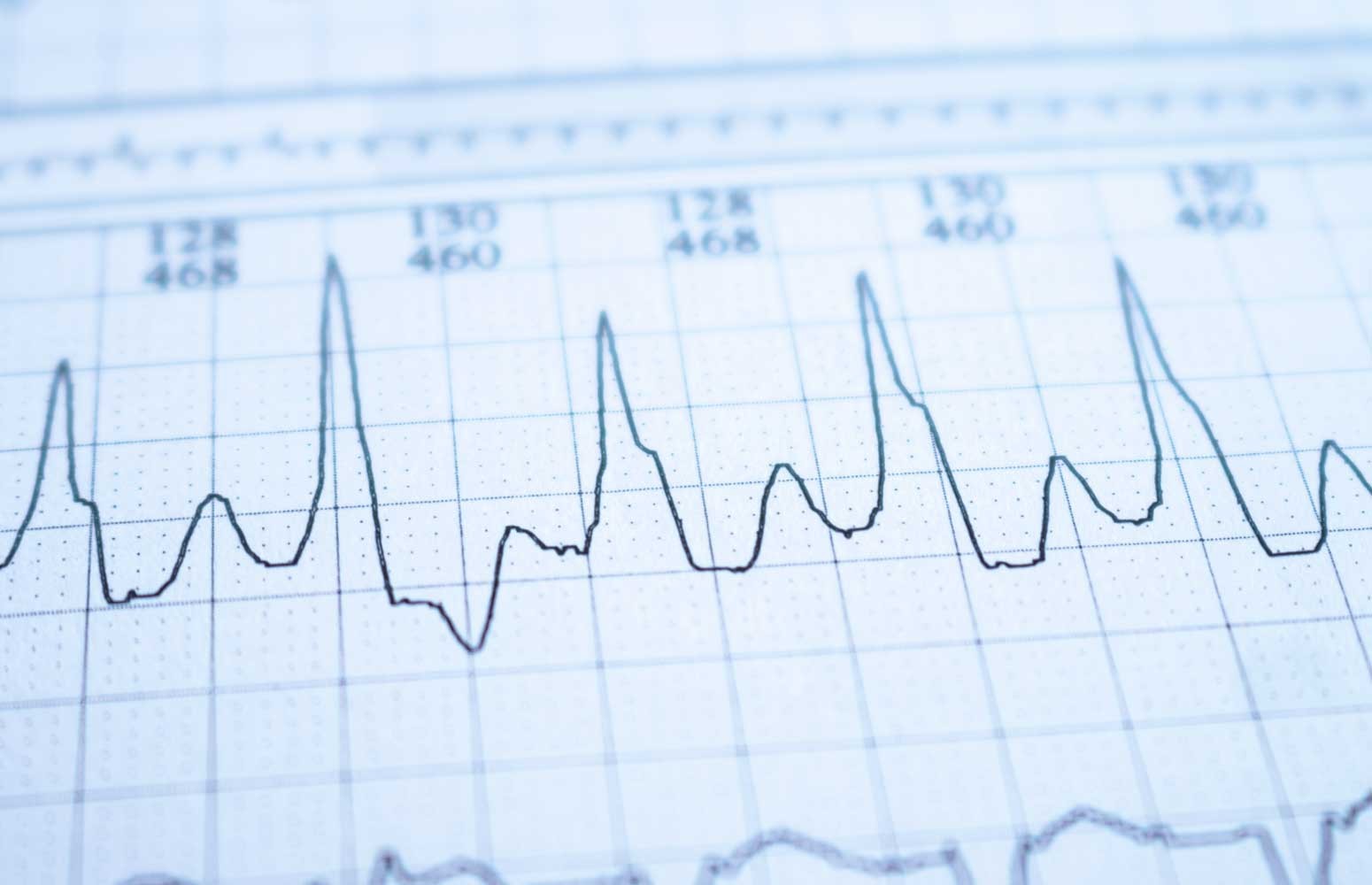 ECG Mastery: Black Belt Workshop