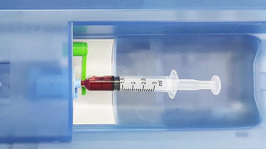 Blood gas