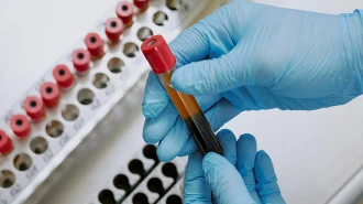 Liver Lab Clinical Guide
