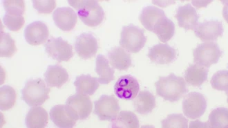 Malaria Clinical Guide
