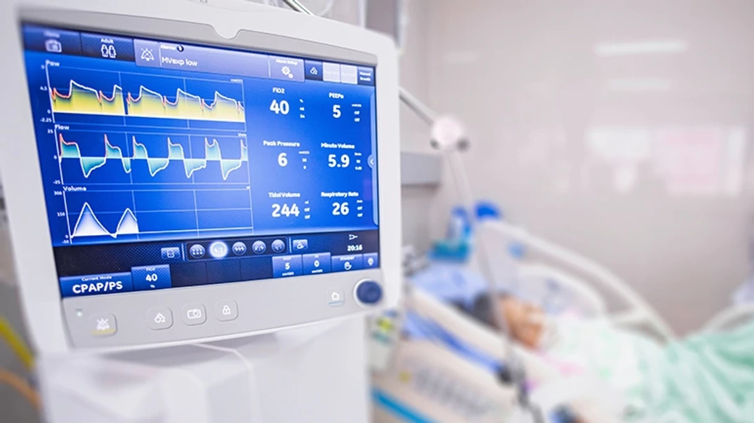 Mechanical ventilation