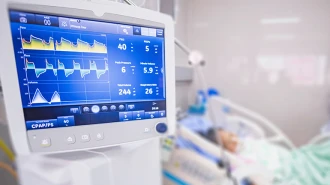 Mechanical Ventilation Clinical Guide