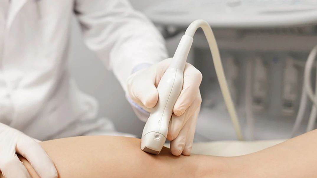 Ultrasound arteries