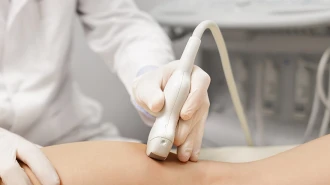 Ultrasound Clinical Guide: Arteries of the Legs
