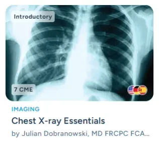 Chest X-ray Essentials course by Julian Dobranowski, MD FRCPC